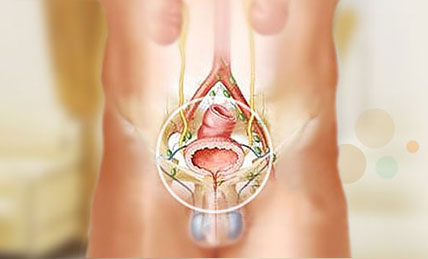 昆明前列腺疾病医院