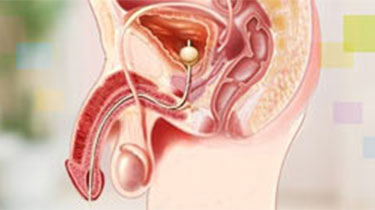 昆明性功能障碍医院