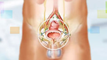 昆明前列腺疾病医院